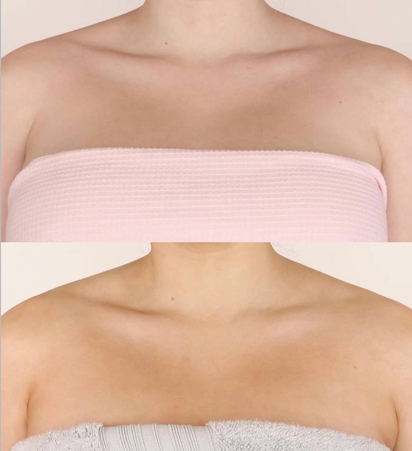 Winter Skin