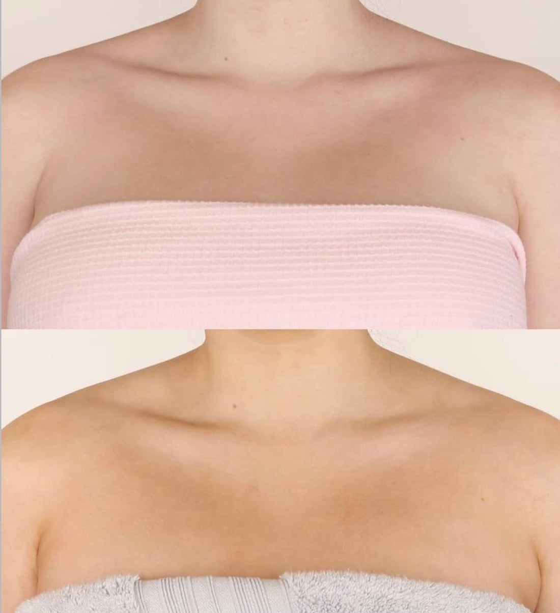 Winter Skin