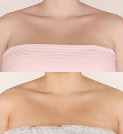 Winter Skin